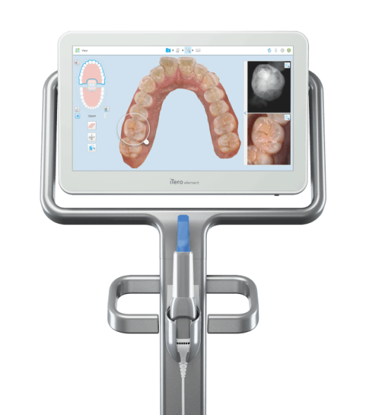 itero-intraoral-scanner